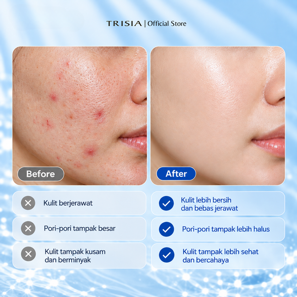 Facial Foam Sophora Anti Acne